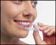woman putting in invisalign tray step 1